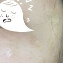 원피부과의원 | 충주 얼굴점 제거｜피부과가 아닌 의원에서 점 뺀 후기(5만원대, 내돈내산)