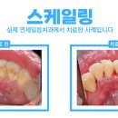 연세일등치과 이미지