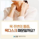 강동굿본재활의학과의원 | 강동구재활병원 경추척수증 케어에 필요한 ‘이것’