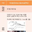 우형개발 이미지