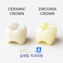 김세일치과의원 | 지르코니아 크라운과 세라믹 크라운 차이 중화동 치과