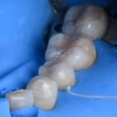 엠웍스 치과기공소 이미지