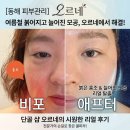 동해 피부관리 여름철에는 쿨링이필요해요 40대 피부샵 방문후기 뷰티그룹 오르네