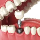 ONE DENTAL 이미지