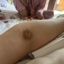 유주메디칼 | 발리5일차_01.09.