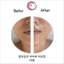 파주 운정 피부관리 저주파 리프팅 맛집 금손네일 내성발톱 무좀 발각질 네일 문제성발