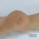 올케어 강남 이미지