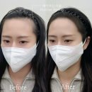 신반포로43길 30 | 얼굴비율 살리는 헤어라인교정 반영구로 자연스럽게 예뻐지고 싶다면 논현오너프룸 M자이마커버 후기!