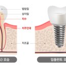 베스트플란트치과의원 이미지