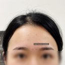 빈빈샵 | 합정역 손이 빠른 왁싱샵 [빈빈왁싱] 망가진 눈썹 되살리기 눈썹왁싱 후기