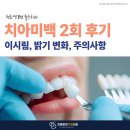 맑은미소치과의원 | 천호역 치아미백 2회 후기 (이시림, 밝기 변화, 주의사항)
