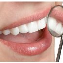 [벌어진 앞니 틈새 치아성형]벌어진 앞니 틈새 치아성형 치료방법 !! 드림치과 이미지