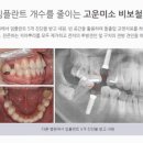 연세고운미소치과의원 이미지