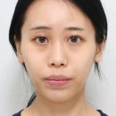 올리팅성형외과의원 이미지