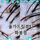 화봉제1공원 | 울산 북구 두피관리 올가드림뷰티 화봉점 두피 디톡스 후기