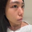 베러미의원 | 강남역피부과 베러미의원 스킨부스터 물광주사 솔직후기