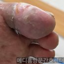 메디홈케어 이미지