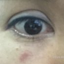 글로비성형외과의원 이미지