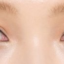 1.0안경콘택트 이미지