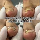 네일은도