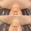 채움에스테틱 이미지