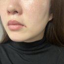 아쿠아 소프트 | 시크릿키 히알루론아쿠아소프트크림 수분크림 일주일 사용 후기