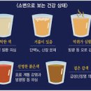 소변색깔 노란색 갈색 소변색 오줌색깔 괜찮을까? 이미지