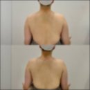 핌케어 | [가정역 에스테틱] 웨딩관리 피부케어 &amp; 라운드숄더 전문 ‘핌 에스테틱’ 내돈내산 후기