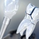 서울허브치과의원 이미지