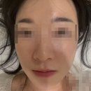 Phase(페이즈) | 대봉동 피부관리 &#39;페이즈 스킨케어&#39;에서 받은 오투덤 산소관리 솔직 후기