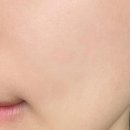 지에프시 | 세라지에프크림 홍조 모낭염 피부과 시술 후 바르는 세라마이드 시카 재생크림 2주 변화 후기