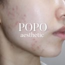 김해삼계 피부샵 포포에스테틱 후기 문제성피부 여드름압출 잘하는곳 추천