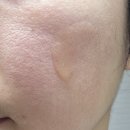 헬스큐어 1공장 | 장벽부스터앰플 마녀공장 비피다 바이옴 콤플렉스 탄력앰플 사용 후기
