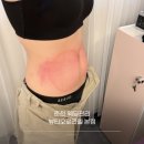 뷰티오로라엘(만천점) | 춘천 웨딩관리 추천 | 뷰티오로라엘 본점 내돈내산 복부관리 후기