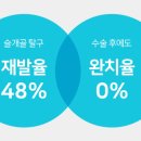 비페이스