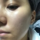 프로모스트 이미지