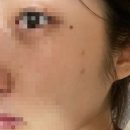 룩스미의원 네이버블로그