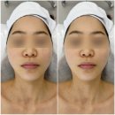 뮤즈온담 에스테틱 | 구파발피부관리 뮤즈온담 에스테틱 작은얼굴 윤곽관리 만족후기