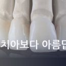 루브르치과 네이버블로그