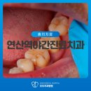 오오치과병원 | 연산역야간진료치과, 충치 방치 시 생길 수 있는 문제는