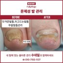 베어수