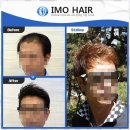 수원-1381 이미지