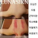 루나스킨케어 - 수원시 영통구 | 루나스킨케어