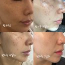 명품피부관리실 - 김천시 | 대구 리프팅, 색소(기미잡티)관리 잘하는곳 수성구 황금동피부관리실에서 명품피부만들기