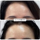 라파사우나 피부관리 | 라파스칼프 영주점 피부관리 후기 시그니처관리
