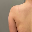 바디케어MK | 동탄역에스테틱 선에스테스파 동탄역점 웨딩드레스라인관리 동탄웨딩케어 동탄역 신부관리 후기