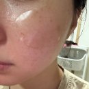 알비 | 출산 후 기미 고민 에슬 essl 알비타치온 기미 세트 사용후기
