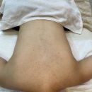 알라딘 | 의정부 스킨스토리 등 알라딘필링 후기