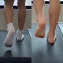 Return청춘 | 대전 봉명동 개인 PT 달리기만 하면 무릎이 아팠던 러너, 1회 만에 달라진 비밀!