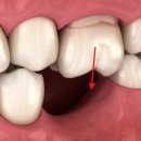 연세세브란스 치과의원 이미지